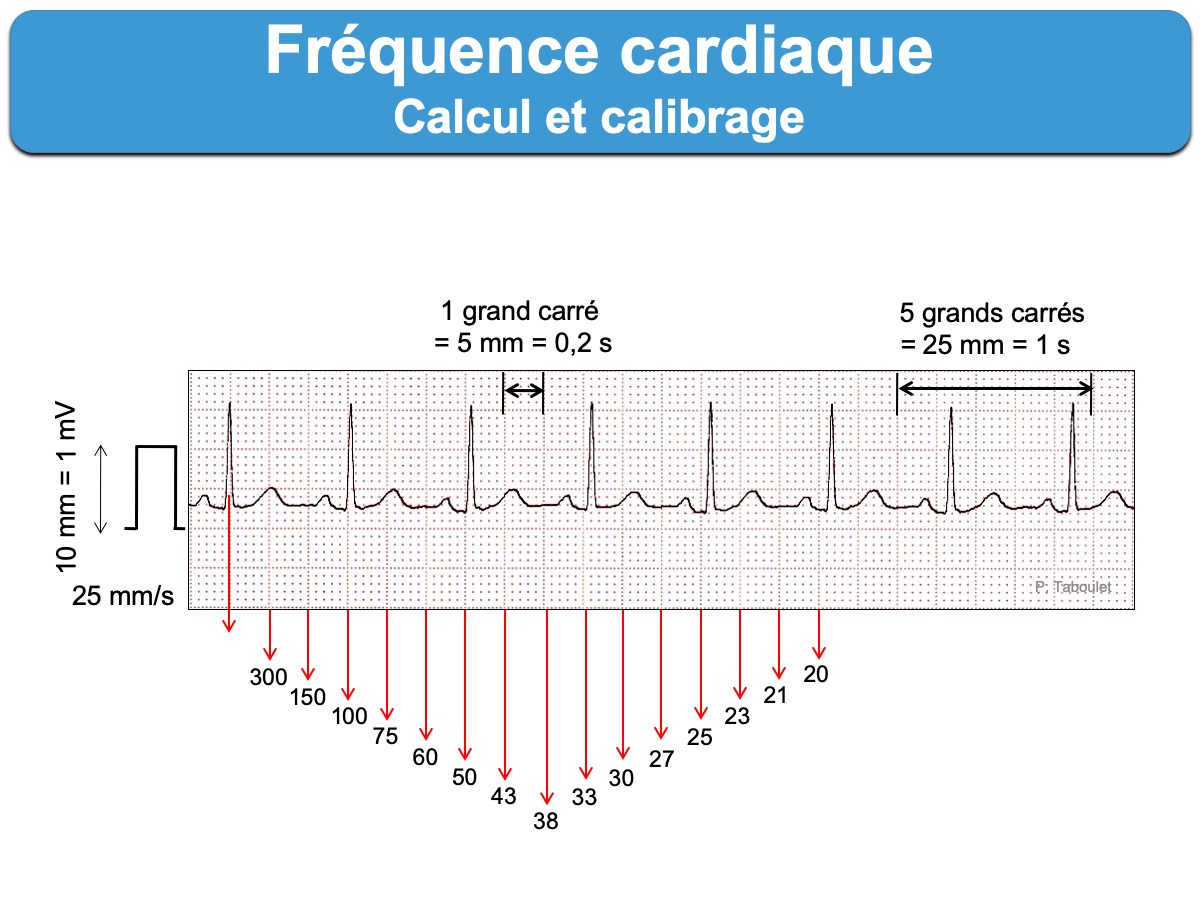 Frequence Cardiaque E Cardiogram