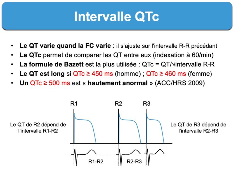 imagen Regresa etiqueta Intervalle QT. 2. QT corrigé (QTc) : e-cardiogram