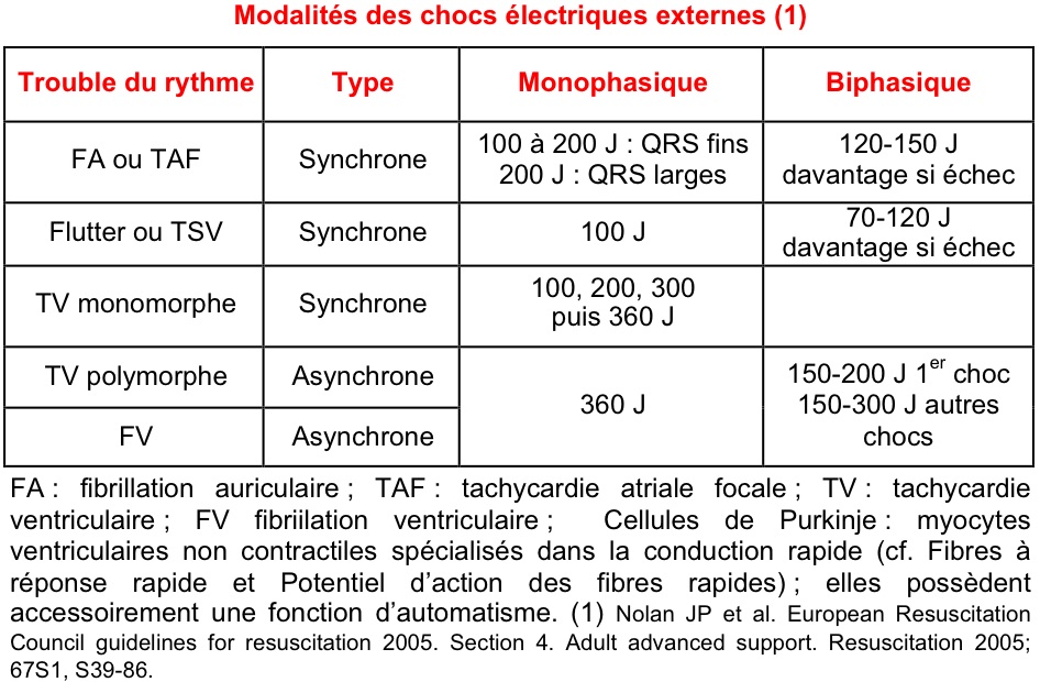 Cardioversion électrique : comment ça se passe ?