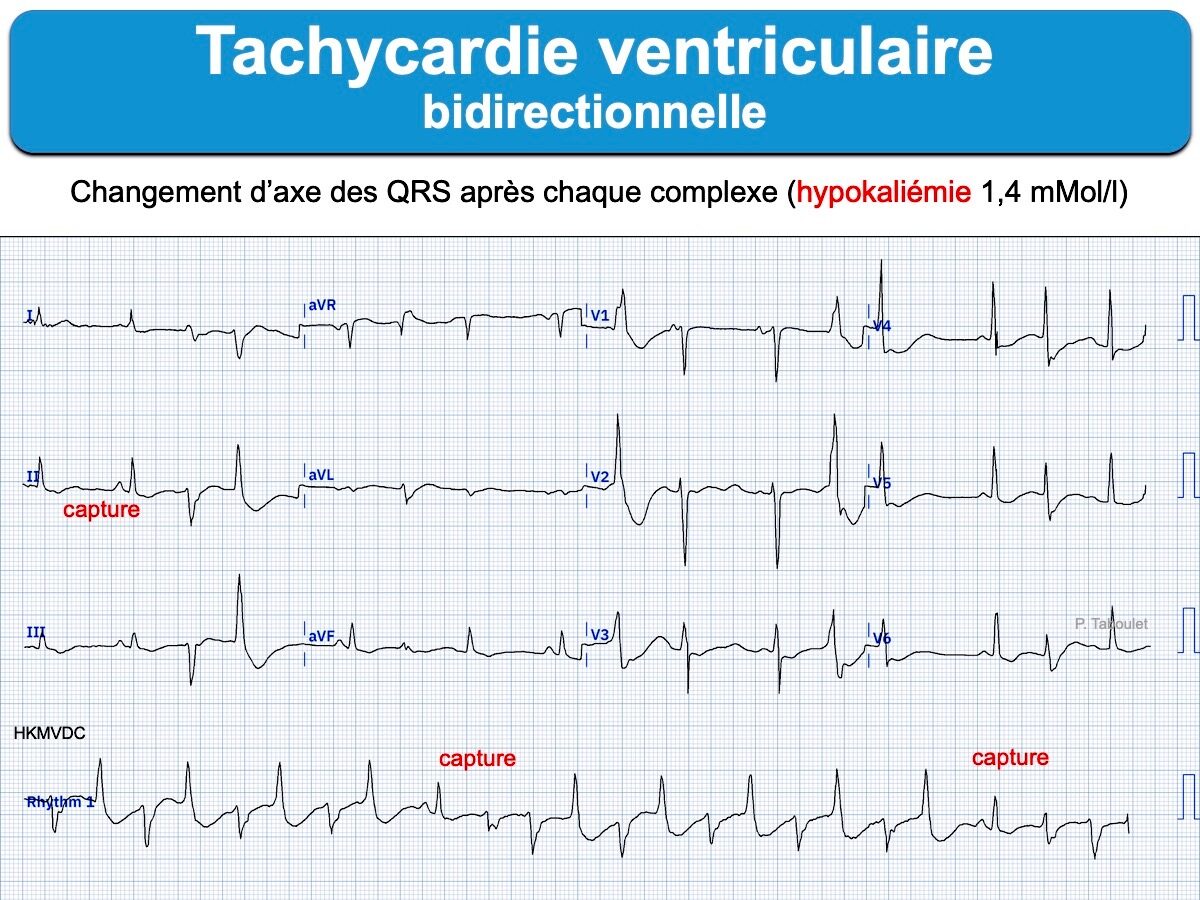 TV 6. bidirectionnelle : e-cardiogram