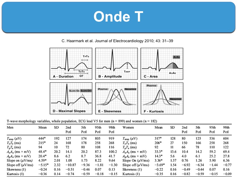 Onde T ecardiogram