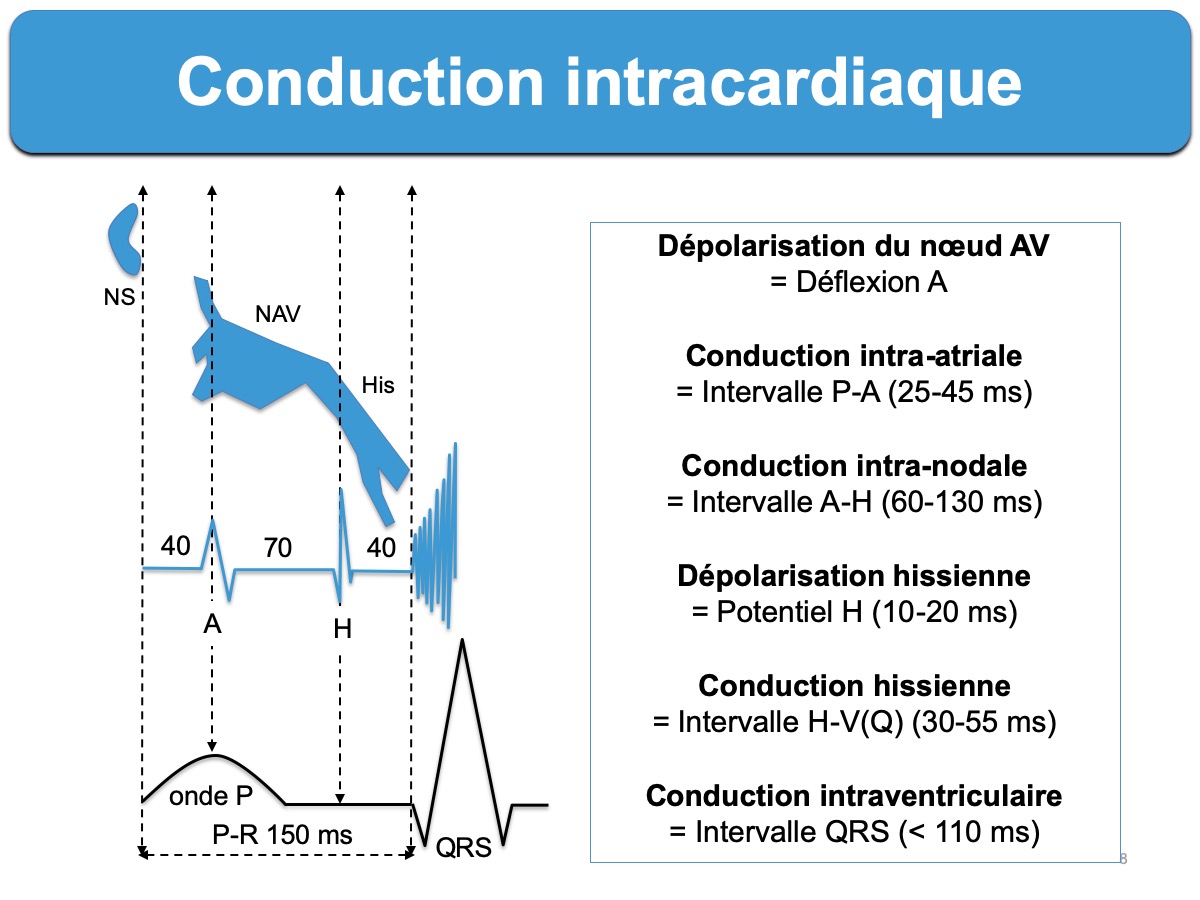 Conduction intracardiaque : e-cardiogram