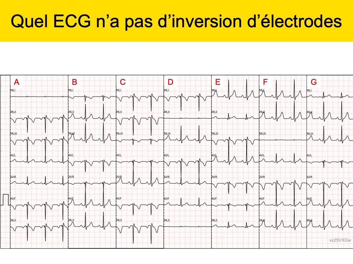 e cardiogram