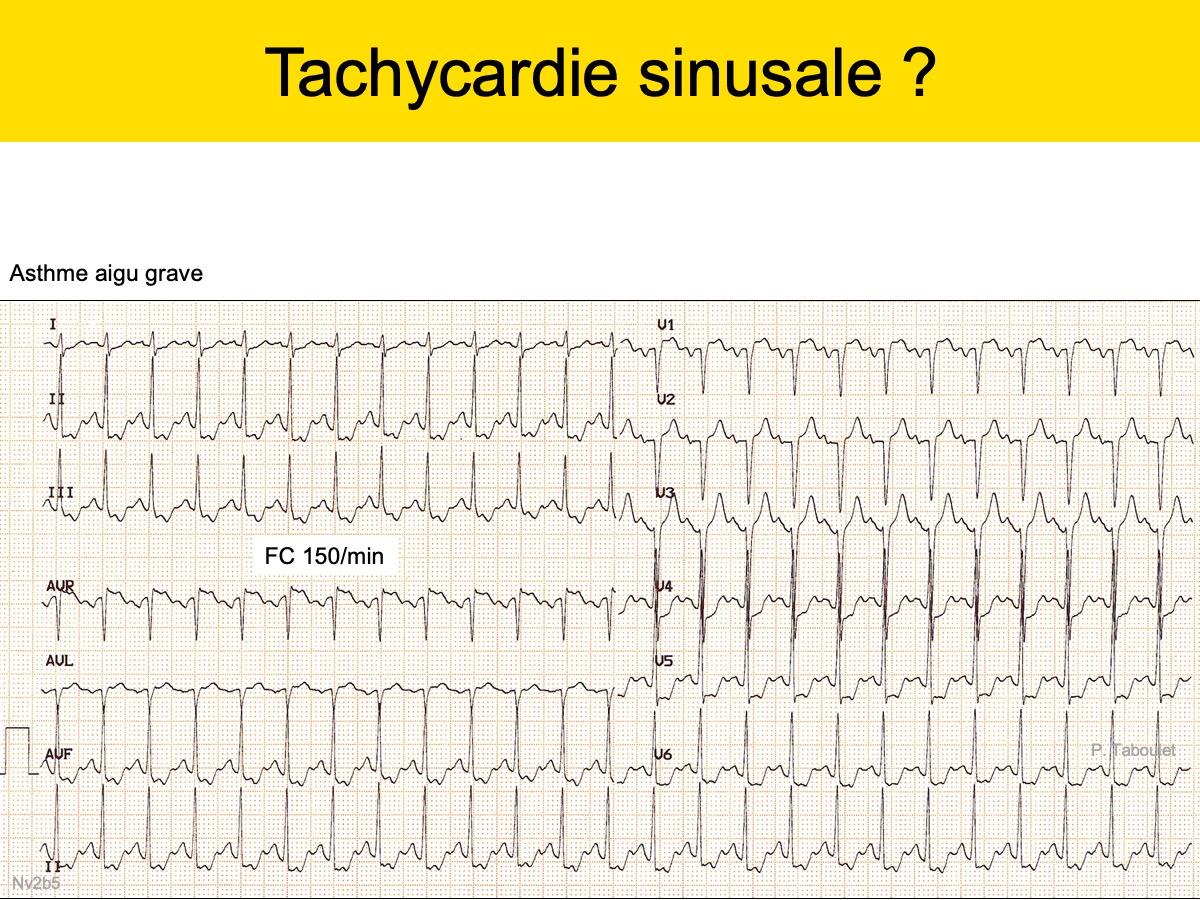 Quiz Evaluation générale 1 (libre accès) ecardiogram