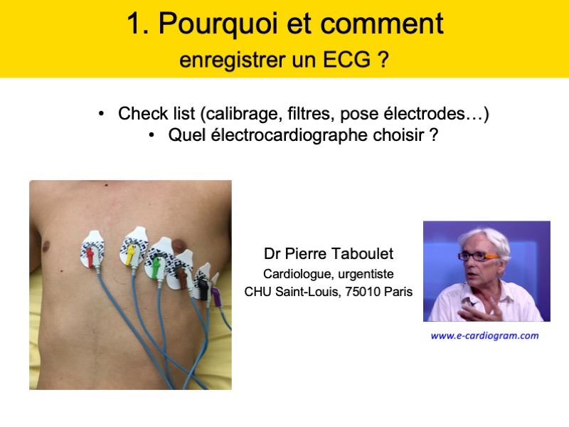 Cours 1. Comment choisir un appareil et enregistrer un ECG ?