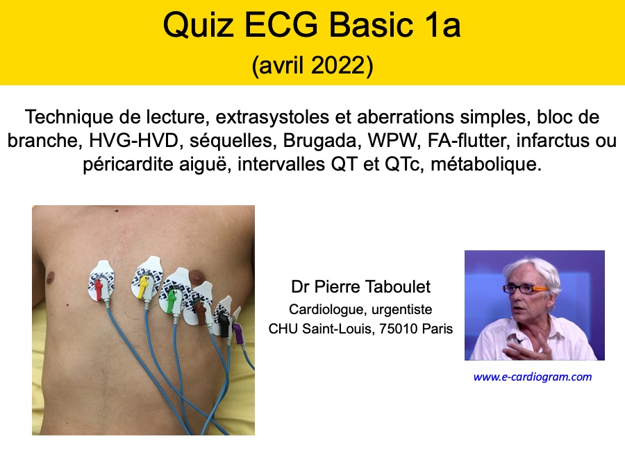 Cours Quiz basic 1a - avril 2022
