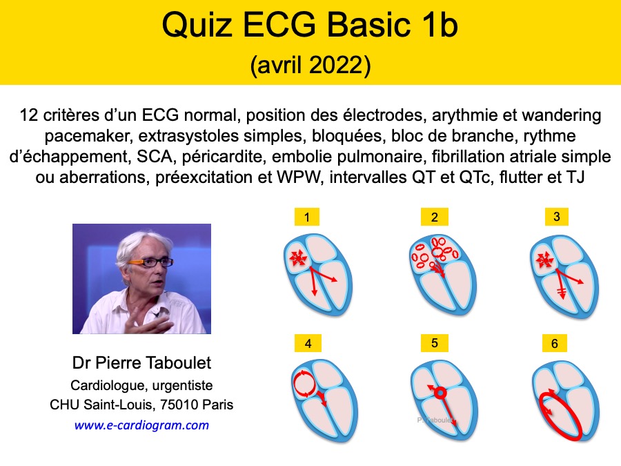 Cours Quiz basic 1b - avril 2022